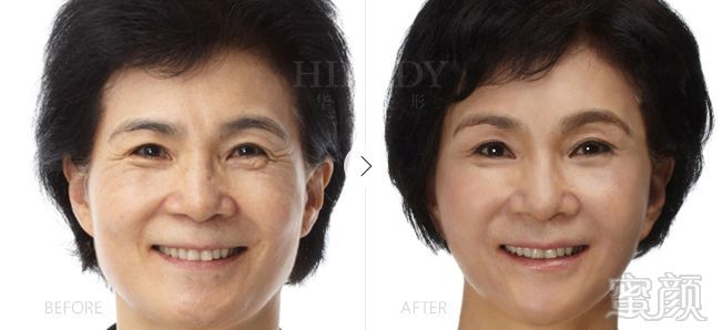 https://img.miyanlife.com/mnt/timg/180203/104G24b6-1.jpg