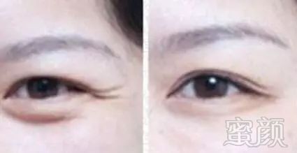 https://img.miyanlife.com/mnt/timg/180203/104G33941-2.jpg