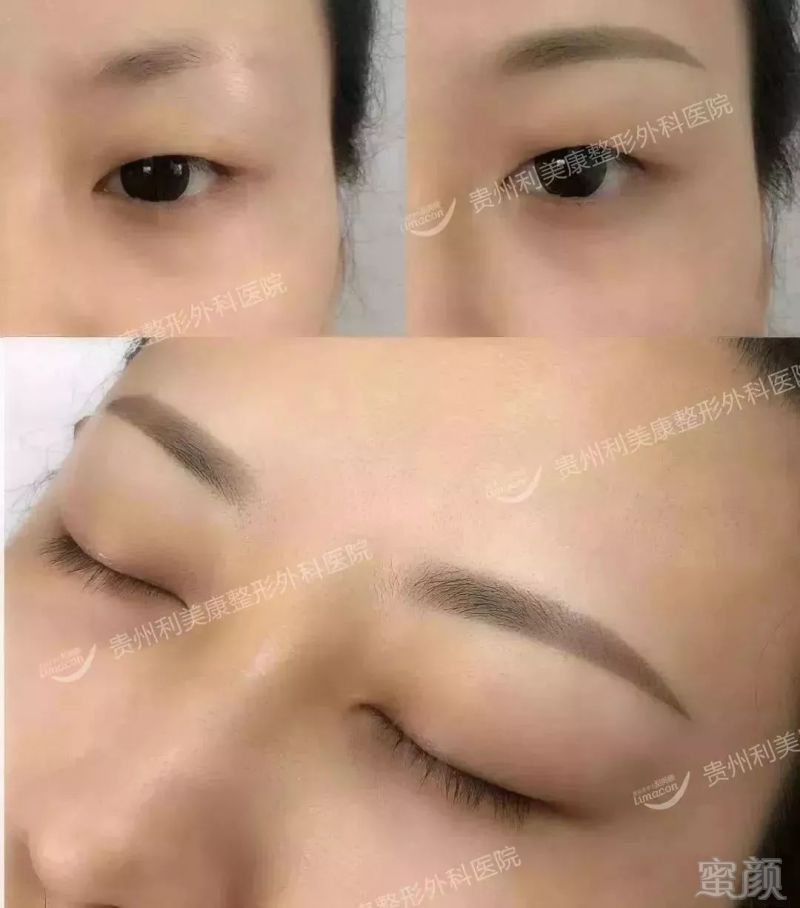 https://img.miyanlife.com/mnt/timg/180203/110443HT-9.jpg