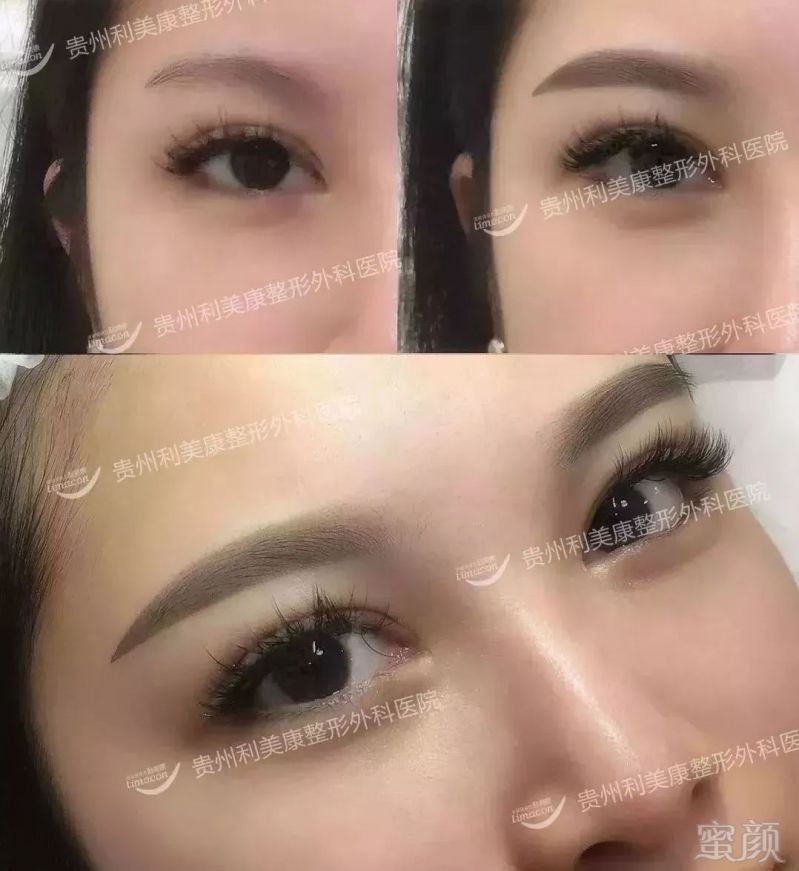 https://img.miyanlife.com/mnt/timg/180203/1104443B9-10.jpg