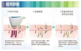 https://img.miyanlife.com/mnt/timg/180203/112T01540-0.jpg