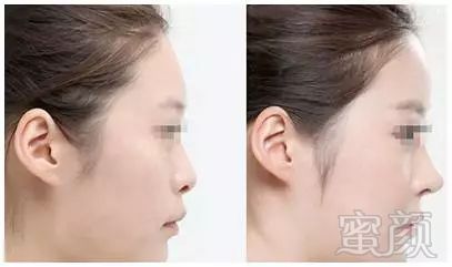 https://img.miyanlife.com/mnt/timg/180203/1143412014-4.jpg