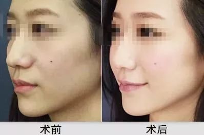 https://img.miyanlife.com/mnt/timg/180203/1143432X3-10.jpg