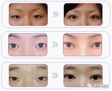 https://img.miyanlife.com/mnt/timg/180203/13061HG0-1.jpg