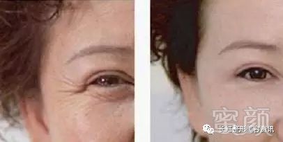 https://img.miyanlife.com/mnt/timg/180203/133421D47-7.jpg