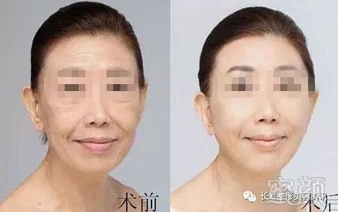 https://img.miyanlife.com/mnt/timg/180203/13342262B-11.jpg