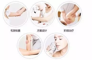 https://img.miyanlife.com/mnt/timg/180203/1405414128-6.jpg