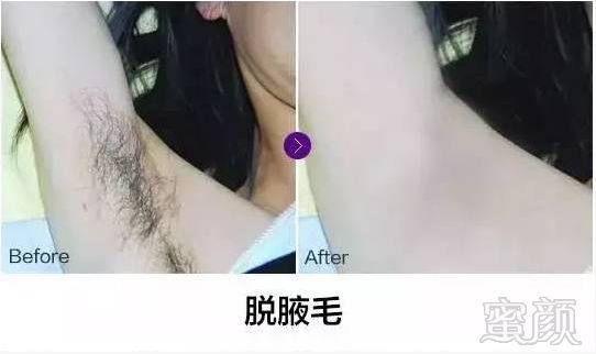 https://img.miyanlife.com/mnt/timg/180203/1405423554-9.jpg