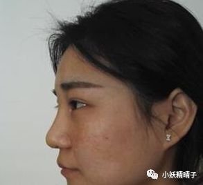 https://img.miyanlife.com/mnt/timg/180203/14400B142-1.jpg