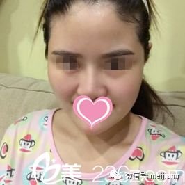 https://img.miyanlife.com/mnt/timg/180204/095H94935-0.jpg