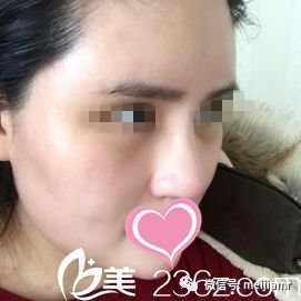 https://img.miyanlife.com/mnt/timg/180204/095H9C30-3.jpg