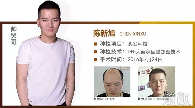 https://img.miyanlife.com/mnt/timg/180204/10361GB8-15.jpg
