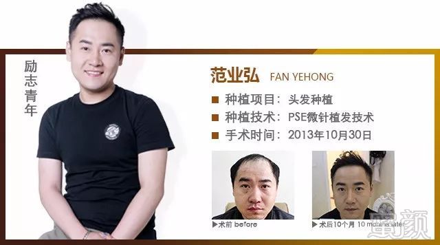 https://img.miyanlife.com/mnt/timg/180204/10361MB4-14.jpg