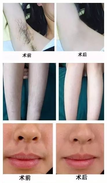 https://img.miyanlife.com/mnt/timg/180204/1045024000-8.jpg