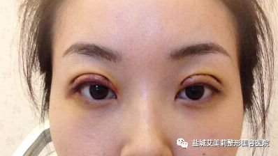 https://img.miyanlife.com/mnt/timg/180204/1049302W0-3.jpg