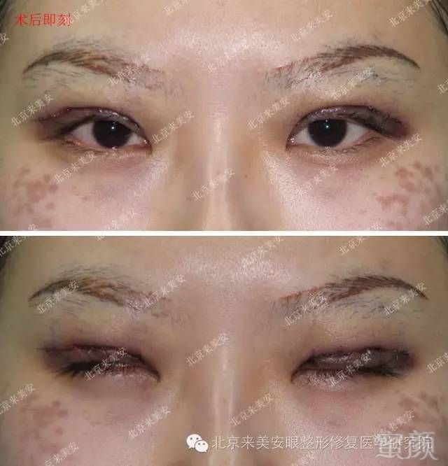 https://img.miyanlife.com/mnt/timg/180204/104F41939-1.jpg