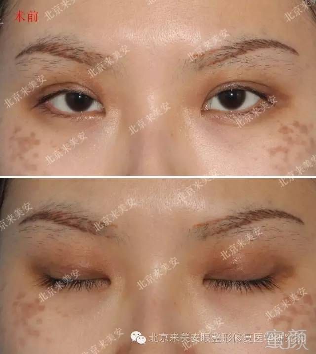 https://img.miyanlife.com/mnt/timg/180204/104F44E9-0.jpg