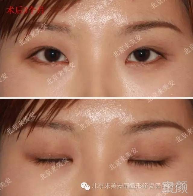 https://img.miyanlife.com/mnt/timg/180204/104F53324-3.jpg