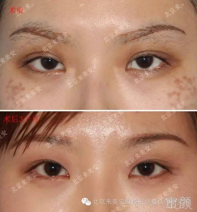 https://img.miyanlife.com/mnt/timg/180204/104F54956-4.jpg