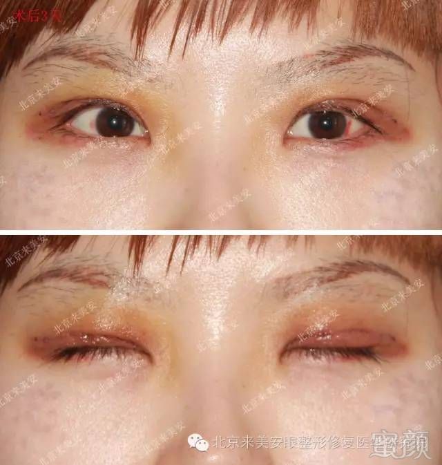 https://img.miyanlife.com/mnt/timg/180204/104F55638-2.jpg