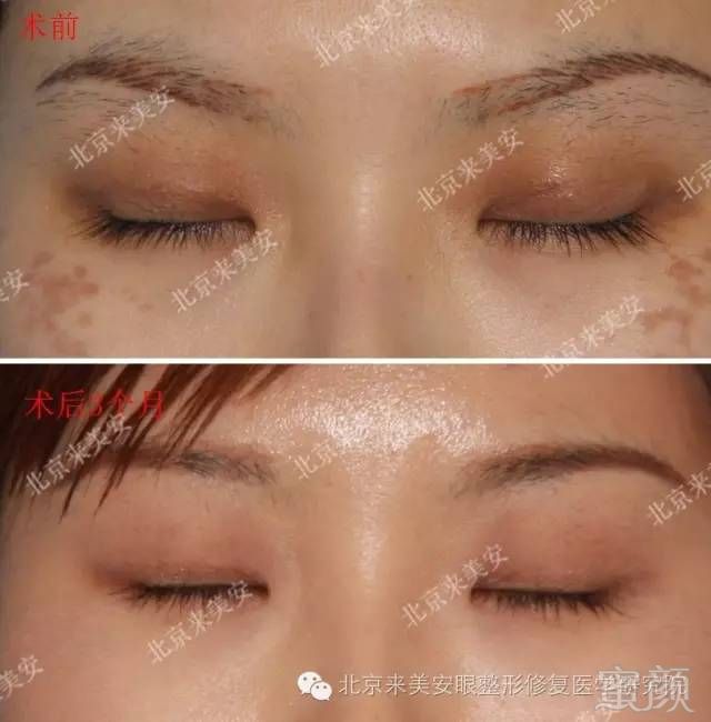 https://img.miyanlife.com/mnt/timg/180204/104F63C4-5.jpg