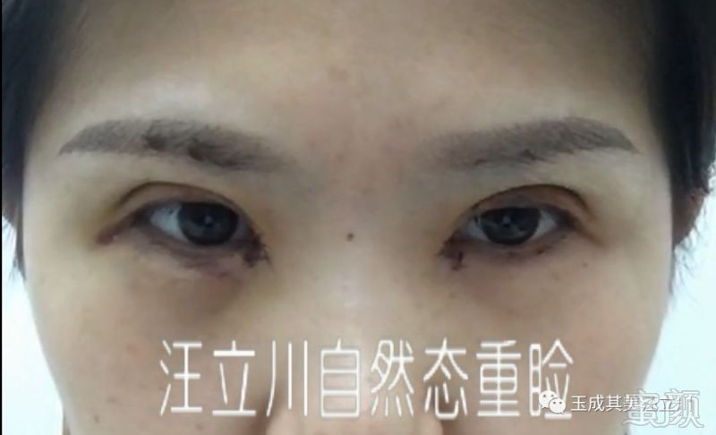 https://img.miyanlife.com/mnt/timg/180204/104J1B62-4.jpg