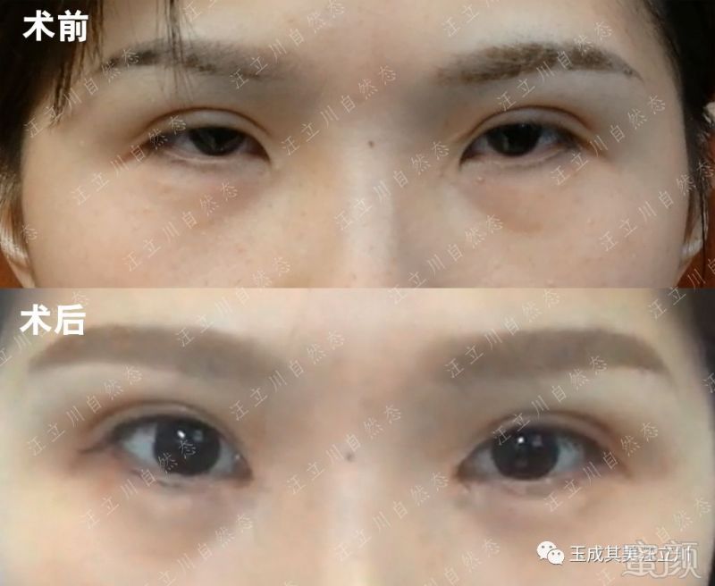 https://img.miyanlife.com/mnt/timg/180204/104J43625-10.jpg