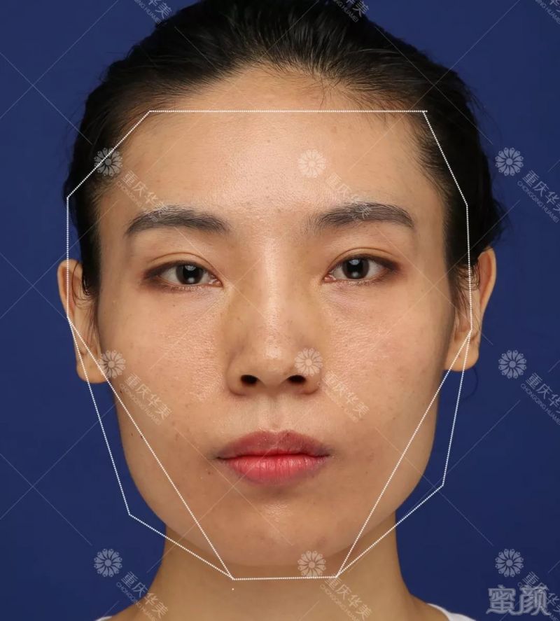 https://img.miyanlife.com/mnt/timg/180204/105U25463-0.jpg