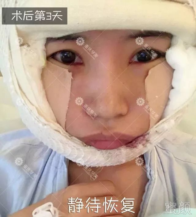 https://img.miyanlife.com/mnt/timg/180204/105U46009-5.jpg