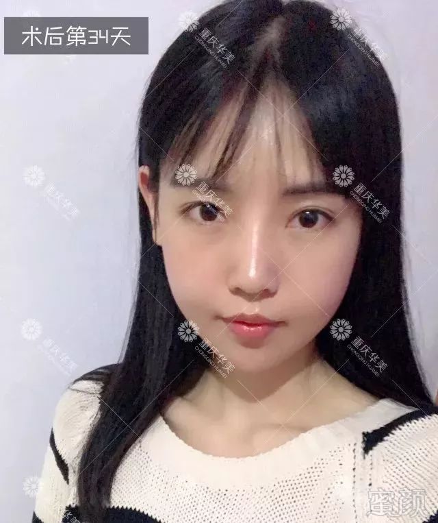 https://img.miyanlife.com/mnt/timg/180204/105UH938-12.jpg