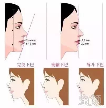 https://img.miyanlife.com/mnt/timg/180204/110I525I-2.jpg