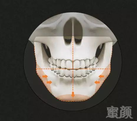 https://img.miyanlife.com/mnt/timg/180204/1112495L4-3.jpg