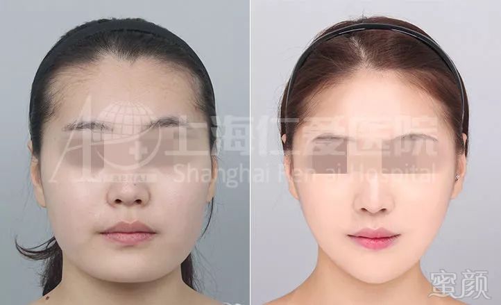 https://img.miyanlife.com/mnt/timg/180204/1112502R6-7.jpg