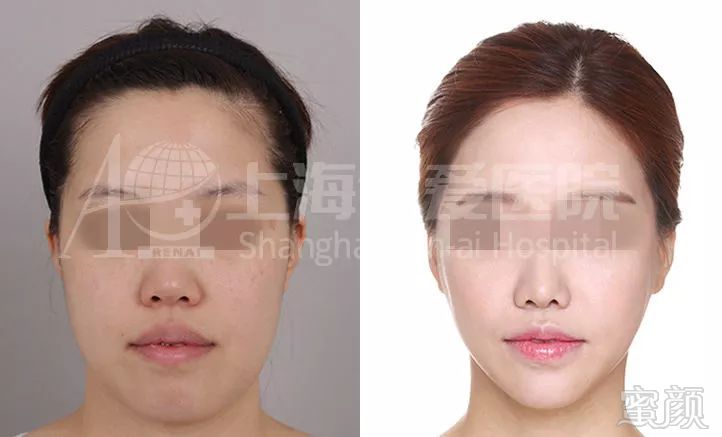 https://img.miyanlife.com/mnt/timg/180204/1112503209-5.jpg