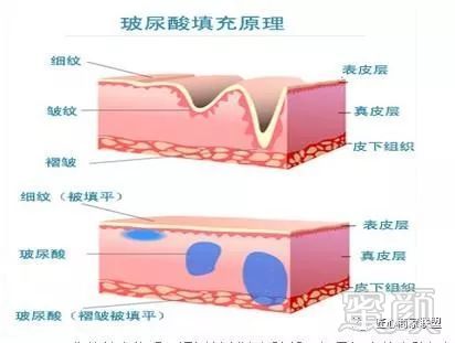 https://img.miyanlife.com/mnt/timg/180204/1201264045-11.jpg