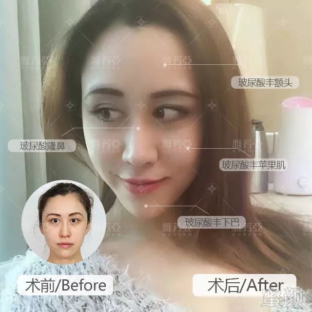 https://img.miyanlife.com/mnt/timg/180205/103UT543-3.jpg