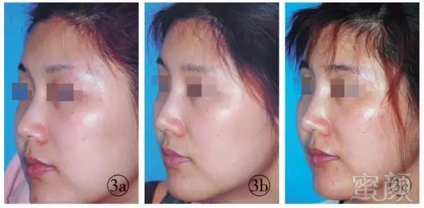 https://img.miyanlife.com/mnt/timg/180205/10463S261-3.jpg