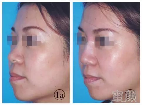 https://img.miyanlife.com/mnt/timg/180205/10463V252-1.jpg