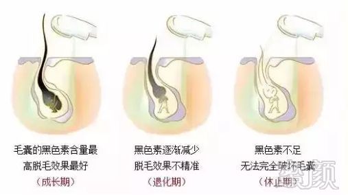 https://img.miyanlife.com/mnt/timg/180205/105Z4D39-2.jpg