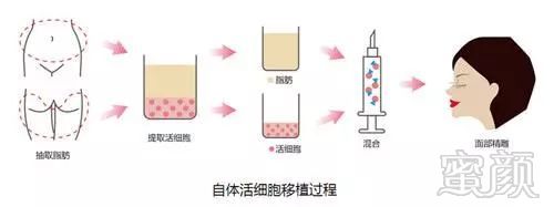 案例图片