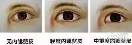 https://img.miyanlife.com/mnt/timg/180205/1141535401-1.jpg