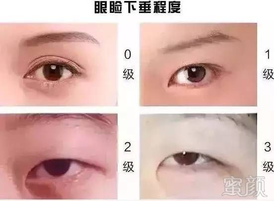 https://img.miyanlife.com/mnt/timg/180205/1141545U3-4.jpg