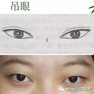 https://img.miyanlife.com/mnt/timg/180205/114154F05-7.jpg