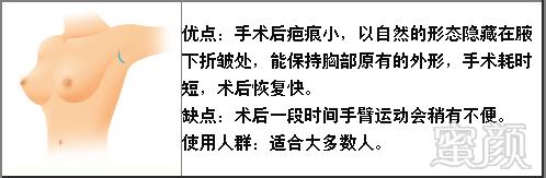 https://img.miyanlife.com/mnt/timg/180205/114Z03003-0.jpg