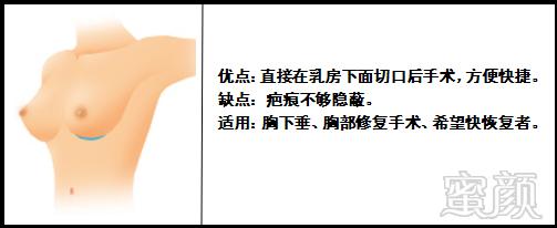 https://img.miyanlife.com/mnt/timg/180205/114Z14132-2.jpg