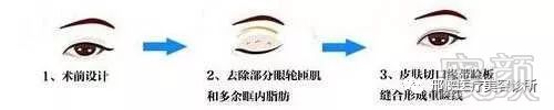 https://img.miyanlife.com/mnt/timg/180205/120Q915M-8.jpg