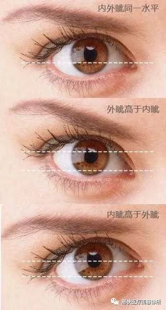 https://img.miyanlife.com/mnt/timg/180205/120R0D10-11.jpg