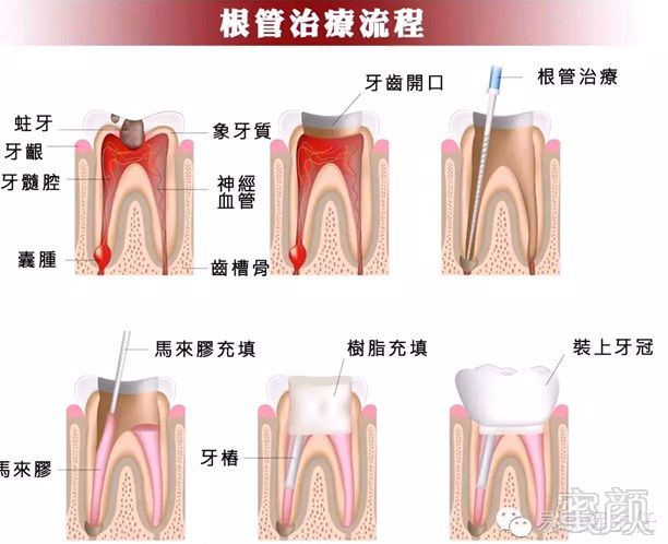 案例图片