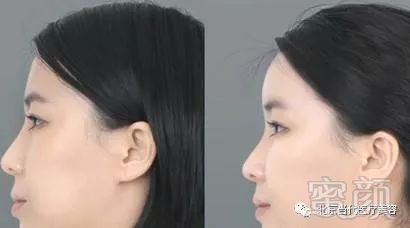 https://img.miyanlife.com/mnt/timg/180205/1230544945-4.jpg