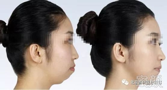 https://img.miyanlife.com/mnt/timg/180205/123055MB-8.jpg